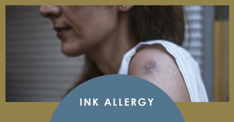What Is Ink Infection What Is Ink Allergy? - Medpundit